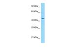 Adiponectin Receptor 2 Antibody in Western Blot (WB)