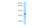 DOHH Antibody in Western Blot (WB)