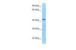 ADAT3 Antibody in Western Blot (WB)