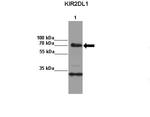 KIR2DL1 Antibody in Immunoprecipitation (IP)