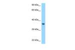 KIR2DL1 Antibody in Western Blot (WB)