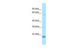 RAP2A Antibody in Western Blot (WB)