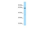 BCMO1 Antibody in Western Blot (WB)