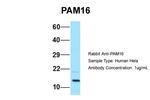 CORO7-PAM16 Antibody in Western Blot (WB)