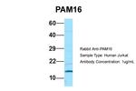 CORO7-PAM16 Antibody in Western Blot (WB)