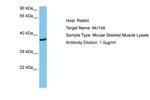 AKR1B8 Antibody in Western Blot (WB)