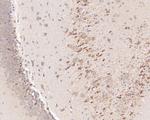 KCNB1 Antibody in Immunohistochemistry (Paraffin) (IHC (P))