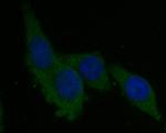 Syntrophin alpha-1 Antibody in Immunocytochemistry (ICC/IF)