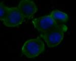 KCNK18 Antibody in Immunocytochemistry (ICC/IF)