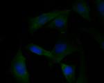 KCNK18 Antibody in Immunocytochemistry (ICC/IF)