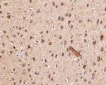 KCNK18 Antibody in Immunohistochemistry (Paraffin) (IHC (P))