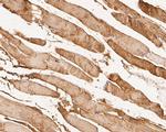 KCNK18 Antibody in Immunohistochemistry (Paraffin) (IHC (P))