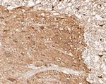 KCNK18 Antibody in Immunohistochemistry (Paraffin) (IHC (P))