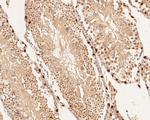 DUX4 Antibody in Immunohistochemistry (Paraffin) (IHC (P))