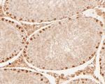 DUX4 Antibody in Immunohistochemistry (Paraffin) (IHC (P))