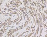 IL8 Antibody in Immunohistochemistry (Paraffin) (IHC (P))