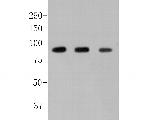 alpha Dystroglycan Antibody in Western Blot (WB)