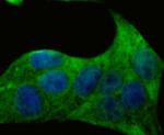 Desmoglein 3 Antibody in Immunocytochemistry (ICC/IF)