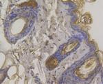 Desmoglein 3 Antibody in Immunohistochemistry (Paraffin) (IHC (P))