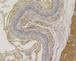 Desmoglein 3 Antibody in Immunohistochemistry (Paraffin) (IHC (P))