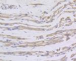 IL-17A Antibody in Immunohistochemistry (Paraffin) (IHC (P))