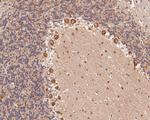 KCNN2 Antibody in Immunohistochemistry (Paraffin) (IHC (P))