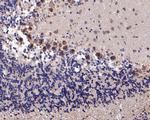 KCNN2 Antibody in Immunohistochemistry (Paraffin) (IHC (P))