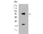 KCNN2 Antibody in Western Blot (WB)