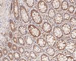 KCNK9 Antibody in Immunohistochemistry (Paraffin) (IHC (P))