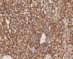 KCNK9 Antibody in Immunohistochemistry (Paraffin) (IHC (P))