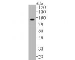 KCNK9 Antibody in Western Blot (WB)