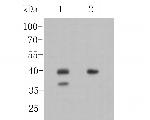 Nkx2.1 Antibody in Western Blot (WB)