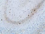 MTR Antibody in Immunohistochemistry (Paraffin) (IHC (P))