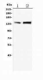 MTR Antibody in Western Blot (WB)