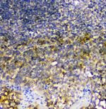 SIRT4 Antibody in Immunohistochemistry (Paraffin) (IHC (P))