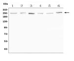 SCN11A Antibody in Western Blot (WB)