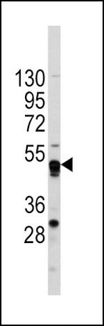 GATA4 Antibody in Western Blot (WB)