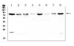 POMT2 Antibody in Western Blot (WB)