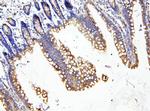 LOR Antibody in Immunohistochemistry (Paraffin) (IHC (P))