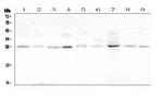 LOR Antibody in Western Blot (WB)