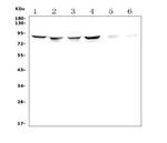 ALDH18A1 Antibody in Western Blot (WB)