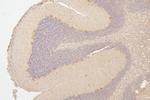 SEMA3B Antibody in Immunohistochemistry (Paraffin) (IHC (P))