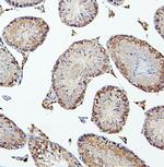 PEF1 Antibody in Immunohistochemistry (Paraffin) (IHC (P))