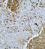 PEF1 Antibody in Immunohistochemistry (Paraffin) (IHC (P))