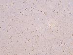 RBMS3 Antibody in Immunohistochemistry (Paraffin) (IHC (P))