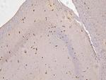 RBMS3 Antibody in Immunohistochemistry (Paraffin) (IHC (P))