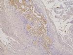 RBMS3 Antibody in Immunohistochemistry (Paraffin) (IHC (P))