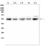 RBMS3 Antibody in Western Blot (WB)