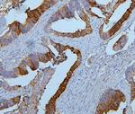 PYROXD1 Antibody in Immunohistochemistry (Paraffin) (IHC (P))