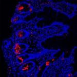 LYZ Antibody in Immunohistochemistry (Paraffin) (IHC (P))